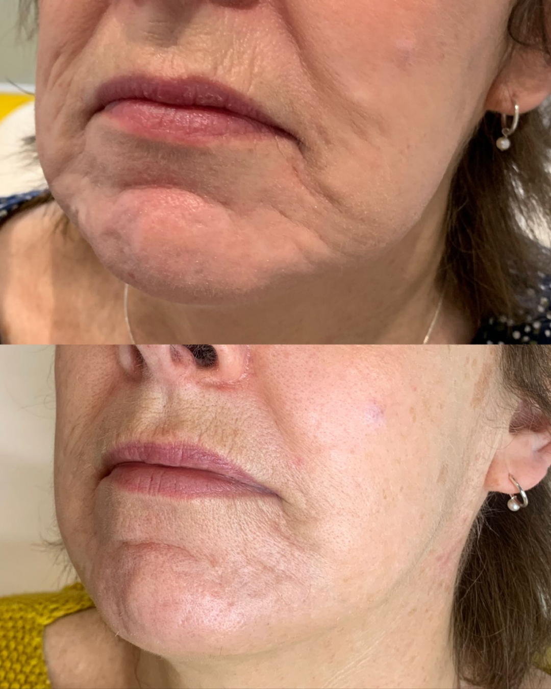 Client result