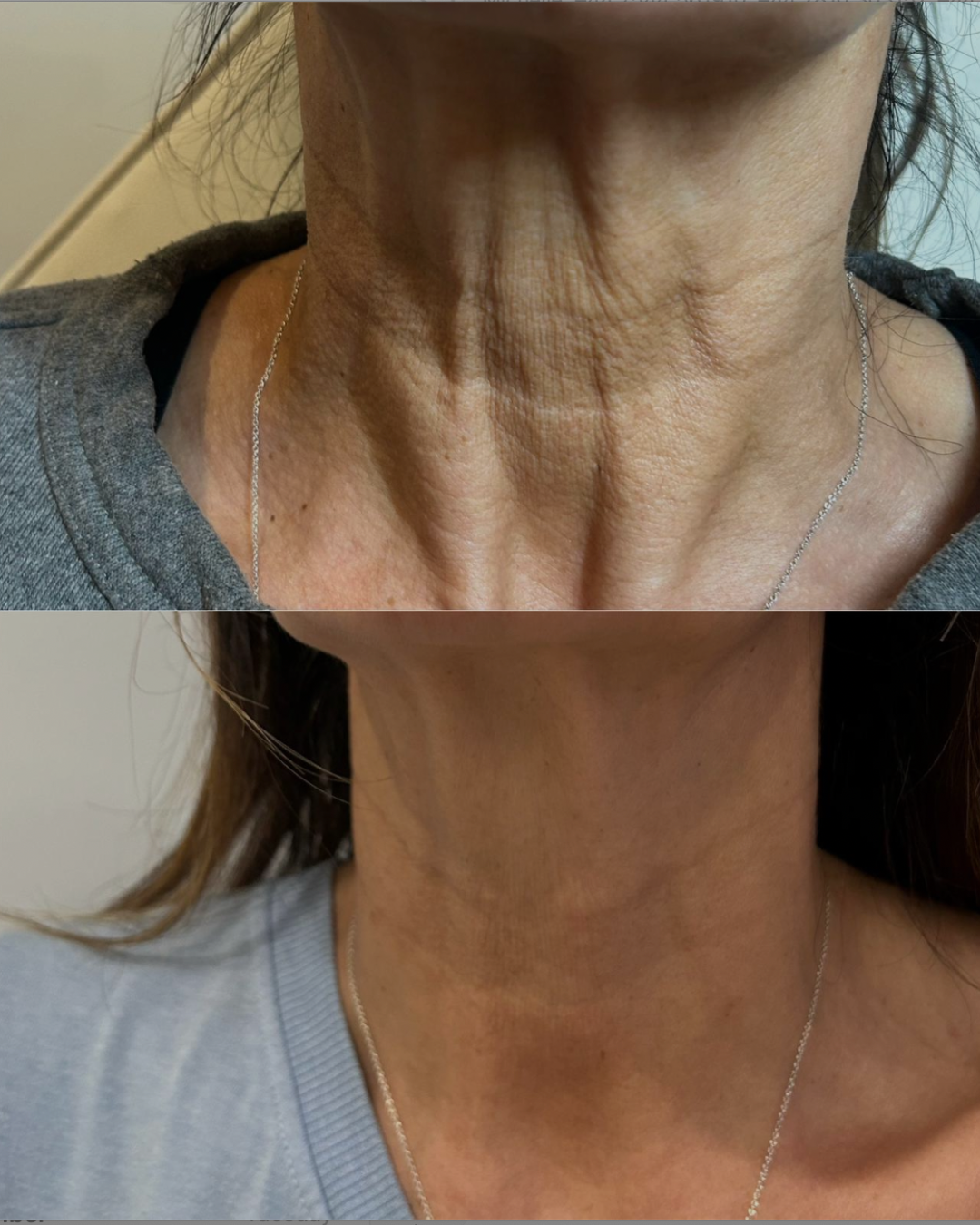 Client result