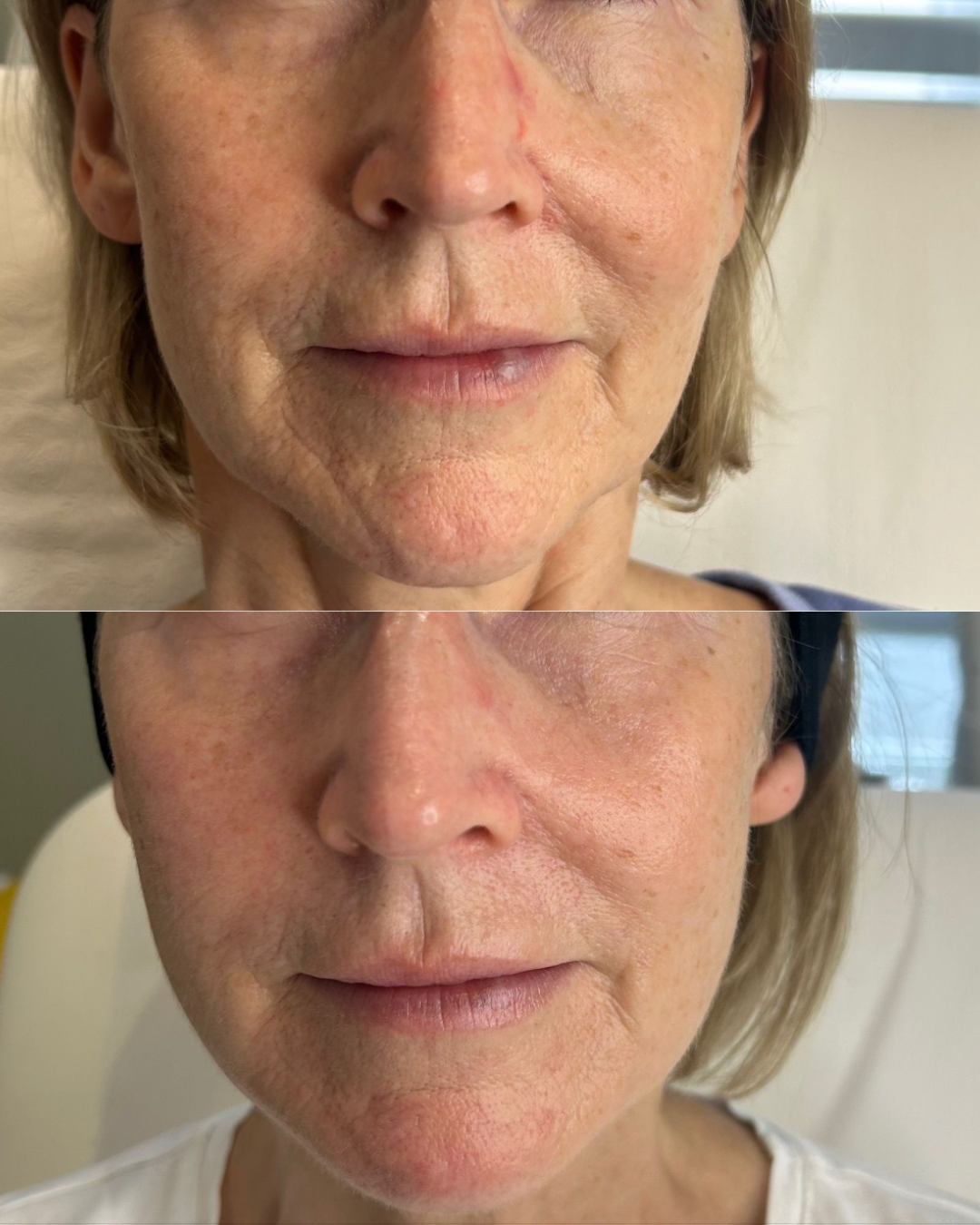 Client result