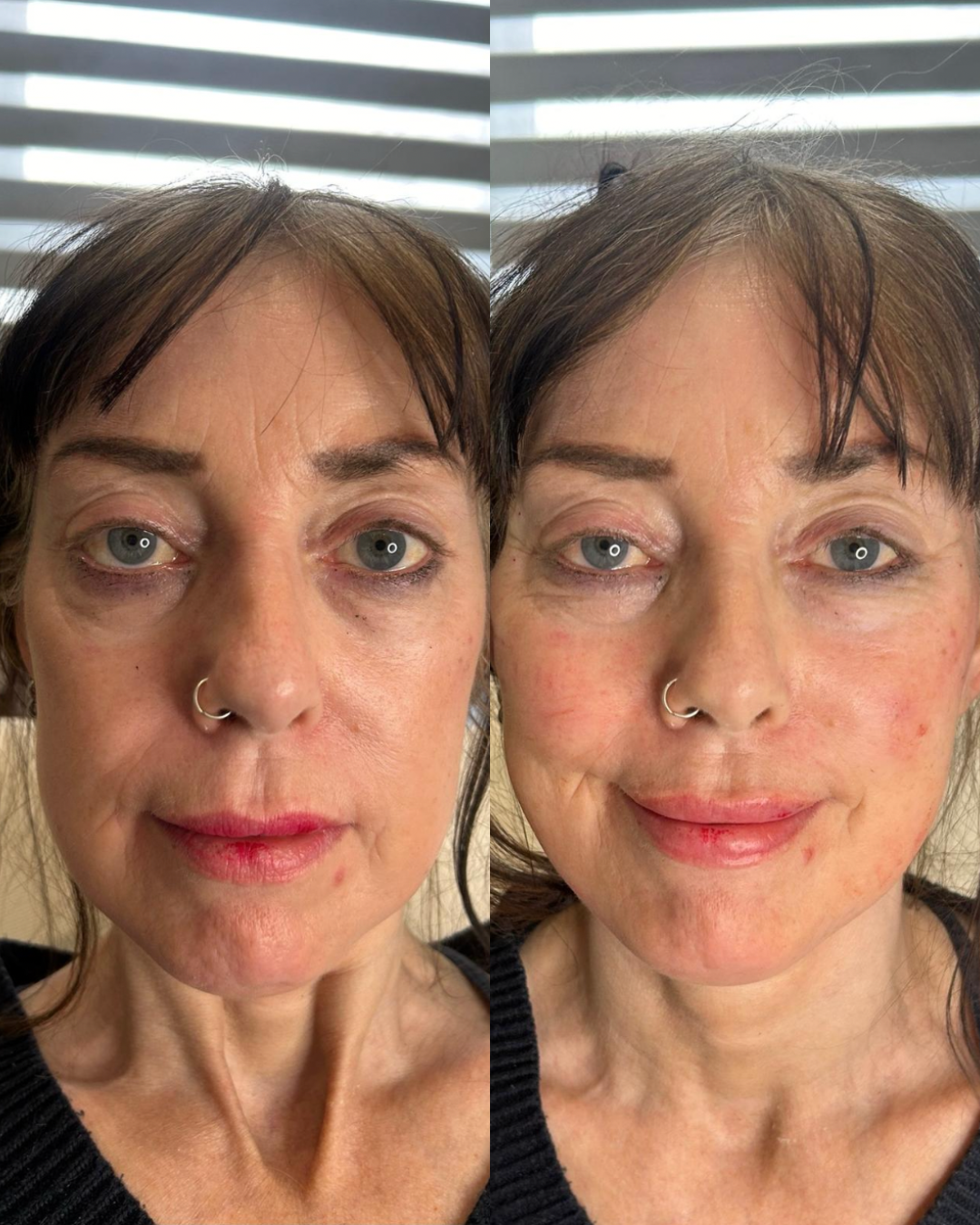 Client result
