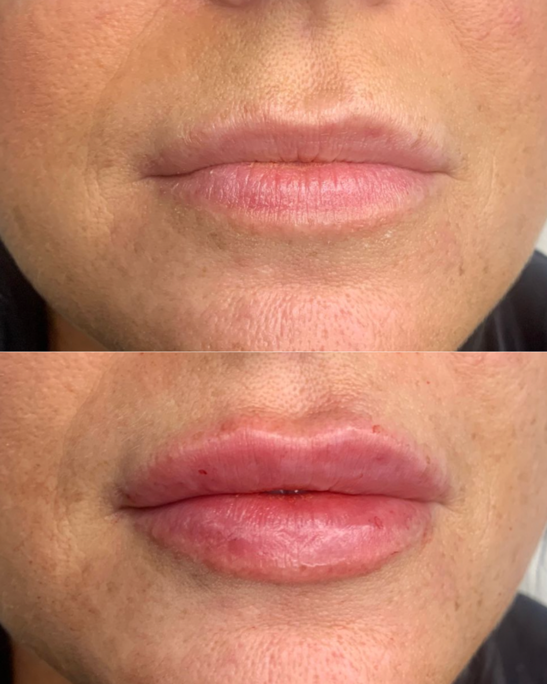 Client result