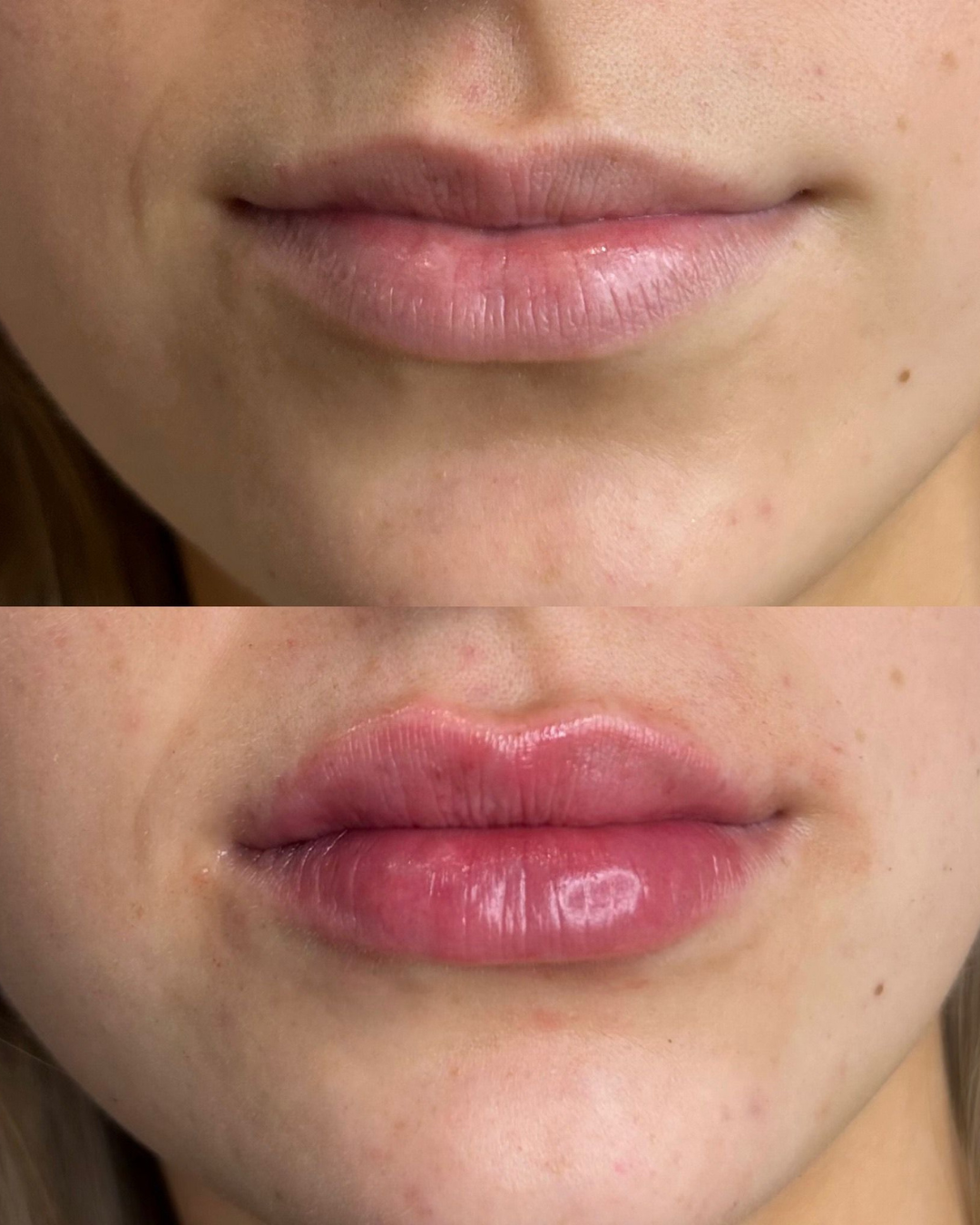 Client result