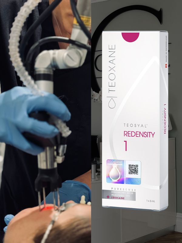 CoolPeel laser and babyGLOW treatment at The Grange Clinic